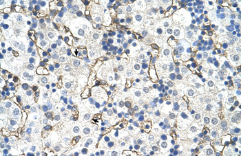 SLC39A5 Rabbit Polyclonal Antibody