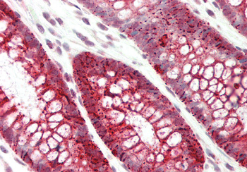 SLC39A5 Rabbit Polyclonal Antibody
