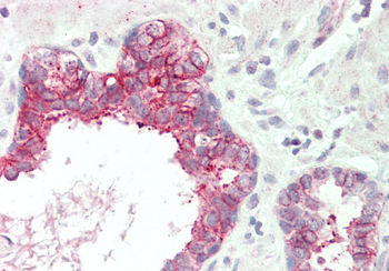 SLC39A5 Rabbit Polyclonal Antibody