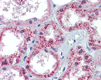 PTCH1 Rabbit Polyclonal Antibody