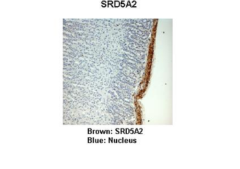 SRD5A2 Rabbit Polyclonal Antibody