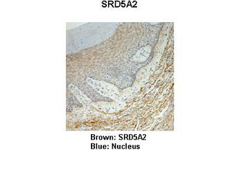 SRD5A2 Rabbit Polyclonal Antibody