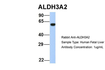 ALDH3A2 Rabbit Polyclonal Antibody