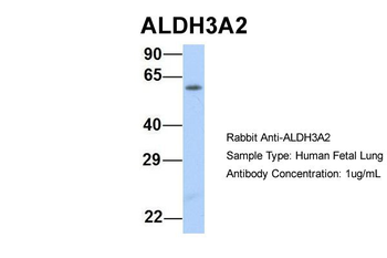 ALDH3A2 Rabbit Polyclonal Antibody