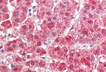 ALDH3A2 Rabbit Polyclonal Antibody