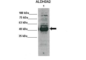 ALDH3A2 Rabbit Polyclonal Antibody