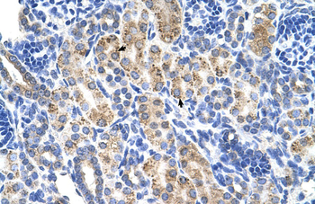 ALDH3A2 Rabbit Polyclonal Antibody
