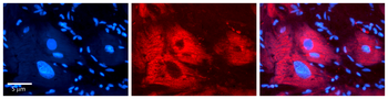 EXT2 Rabbit Polyclonal Antibody