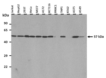 ACVR1 Rabbit Polyclonal Antibody