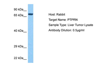 PTPRN Rabbit Polyclonal Antibody