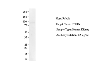 PTPRN Rabbit Polyclonal Antibody