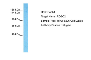 ROBO2 Rabbit Polyclonal Antibody