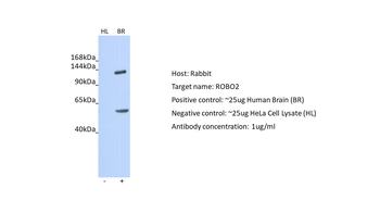 ROBO2 Rabbit Polyclonal Antibody