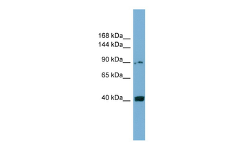 UNC5C Rabbit Polyclonal Antibody