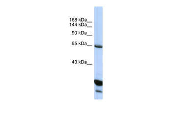 UNC5C Rabbit Polyclonal Antibody