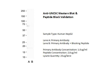 UNC5C Rabbit Polyclonal Antibody