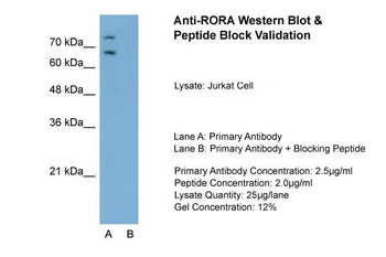 RORA Rabbit Polyclonal Antibody