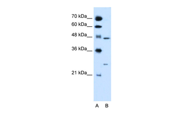 RXRG Rabbit Polyclonal Antibody