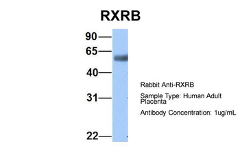 RXRB Rabbit Polyclonal Antibody