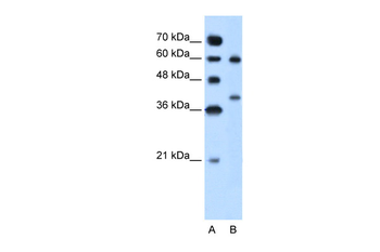 ARG1 Rabbit Polyclonal Antibody