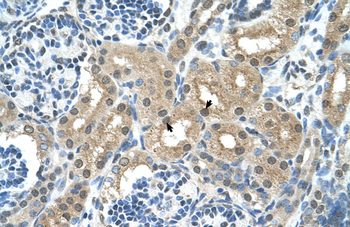 GPT Rabbit Polyclonal Antibody