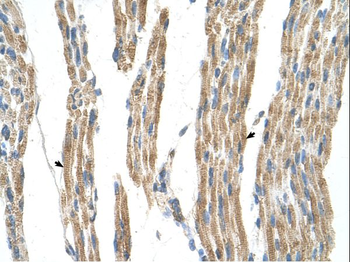 GPT Rabbit Polyclonal Antibody