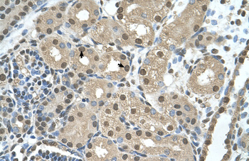SBDS Rabbit Polyclonal Antibody