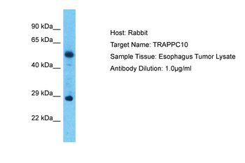 TRAPPC10 Rabbit Polyclonal Antibody
