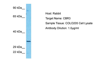 CBR3 Rabbit Polyclonal Antibody