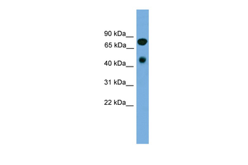 RIPK4 Rabbit Polyclonal Antibody