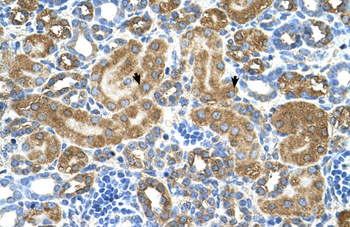 ATIC Rabbit Polyclonal Antibody