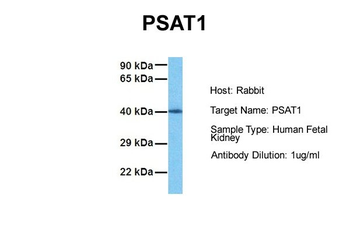 PSAT1 Rabbit Polyclonal Antibody