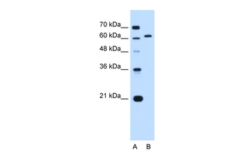 LMNB2 Rabbit Polyclonal Antibody
