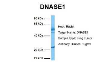 DNASE1 Rabbit Polyclonal Antibody