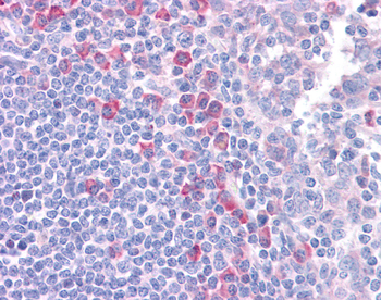 DLL1 Rabbit Polyclonal Antibody