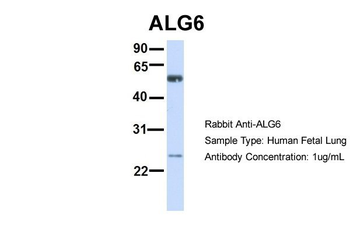 ALG6 Rabbit Polyclonal Antibody