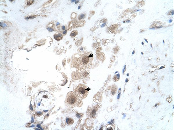 KIAA0494 Rabbit Polyclonal Antibody