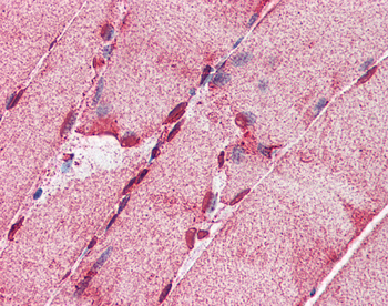 ACSL5 Rabbit Polyclonal Antibody