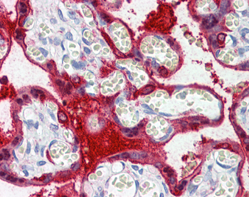 TGM2 Rabbit Polyclonal Antibody