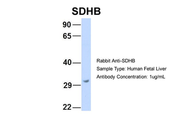 SDHB Rabbit Polyclonal Antibody