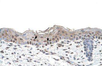 ARRB2 Rabbit Polyclonal Antibody