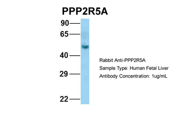PPP2R5A Rabbit Polyclonal Antibody