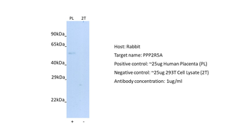PPP2R5A Rabbit Polyclonal Antibody
