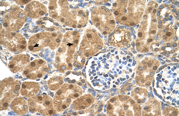 PTGDS Rabbit Polyclonal Antibody