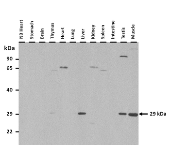 IGFBP7 Rabbit Polyclonal Antibody