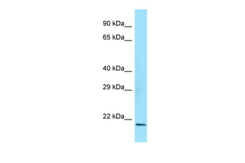 Cryab Rabbit Polyclonal Antibody