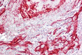 Tagln Rabbit Polyclonal Antibody