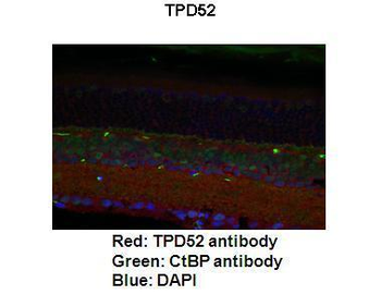 TPD52 Rabbit Polyclonal Antibody