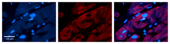 CAP1 Rabbit Polyclonal Antibody
