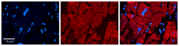 CPT2 Rabbit Polyclonal Antibody